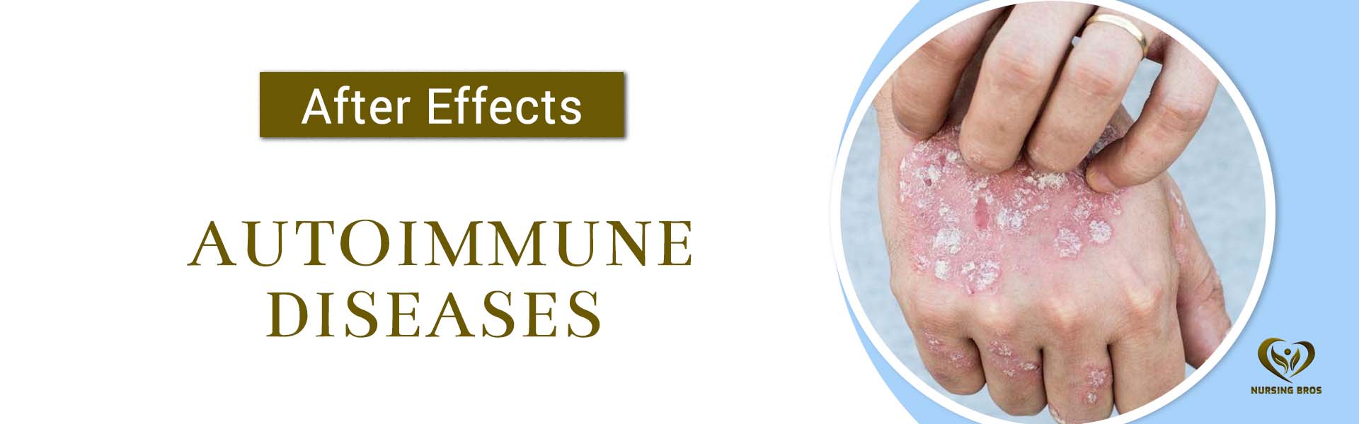 Autoimmune Diseases desktop