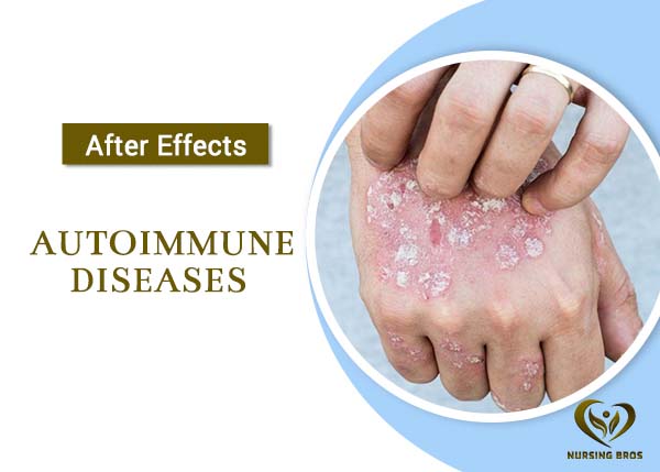 Autoimmune Diseases mobile