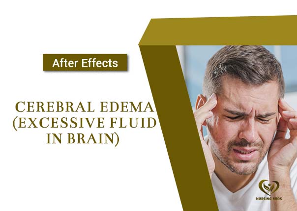 Cerebral Edema mobile