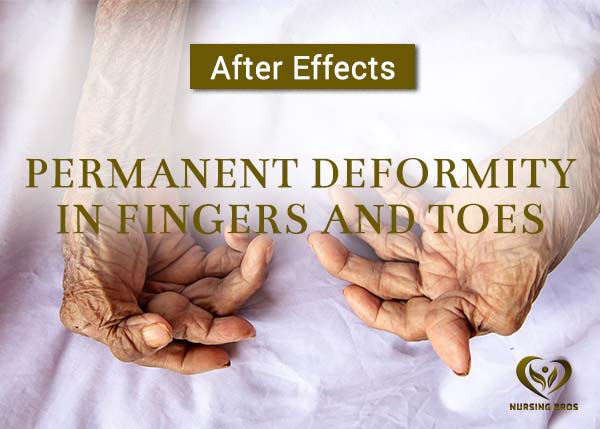 finger and toes mobile