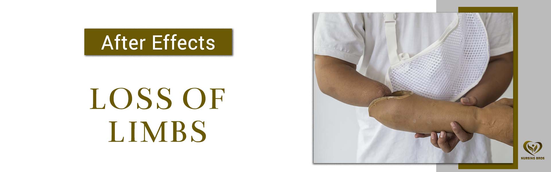 loss of limbs desktop