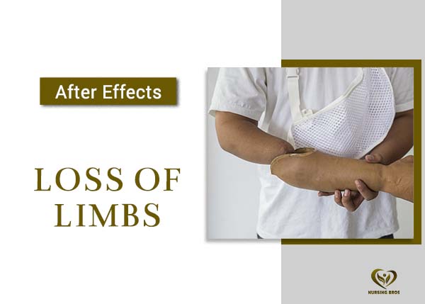 loss of limbs mobile